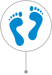 Plantar Fasciitis