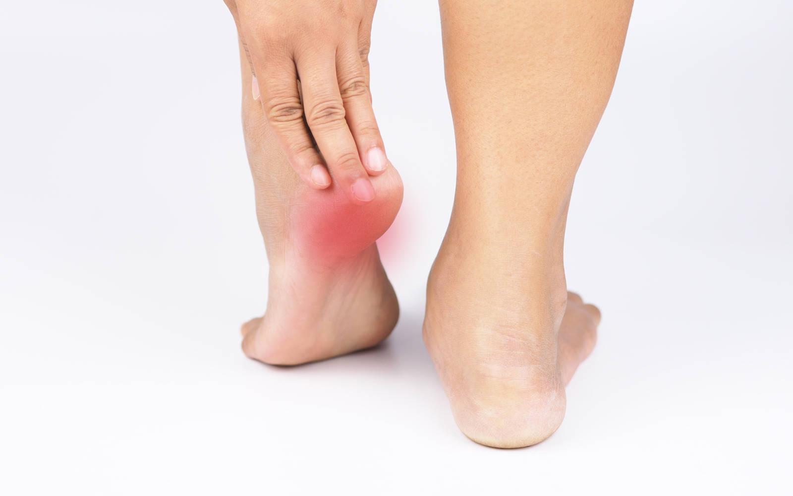 Plantar Fasciitis